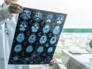 Journee mondiale de la maladie d'Alzheimer