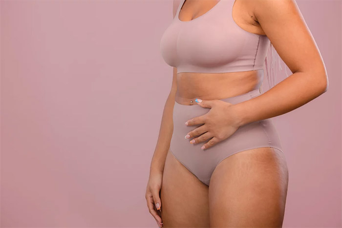 sopk syndrome ovaires polykystiques facteur de risque surpoids obesite