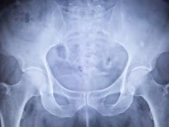 pubalgie sportif symptomes traitement prevention diagnostic douleur aine pubis reeducation chirurgie athletes