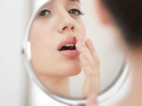 herpes hsv virus infection symptomes bouton fievre