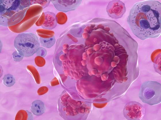 traitement diabete metformine prevention leucemie