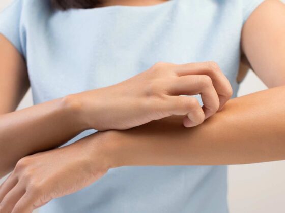 allergie alimentaire peau blessure protection barriere cutanee