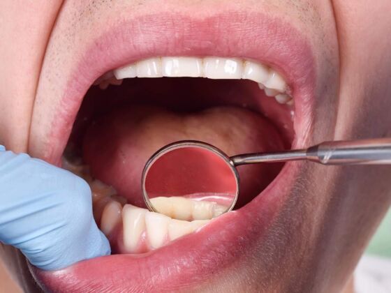 parkinson bacterie buccale streptococcusmutans microbiote intestin