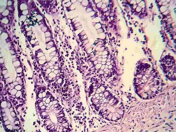 bacteries intestinales impliquees dans la depression