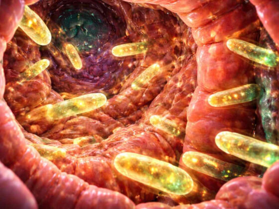 votre intestin cache peut etre cause lupus