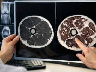 aliments ultra-transformes muscles remplissent graisse