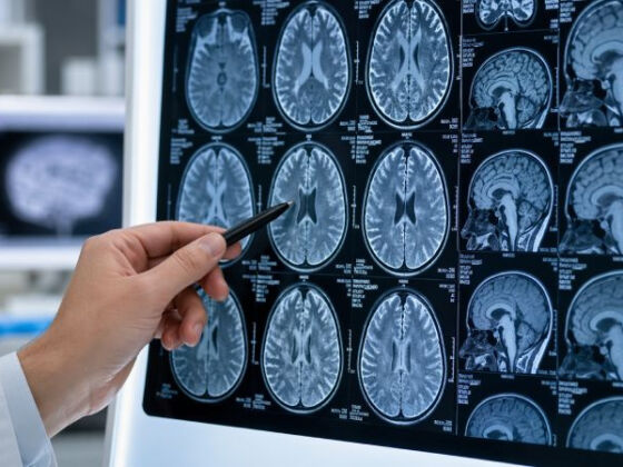 diabete laisse des traces alzheimer dans sang