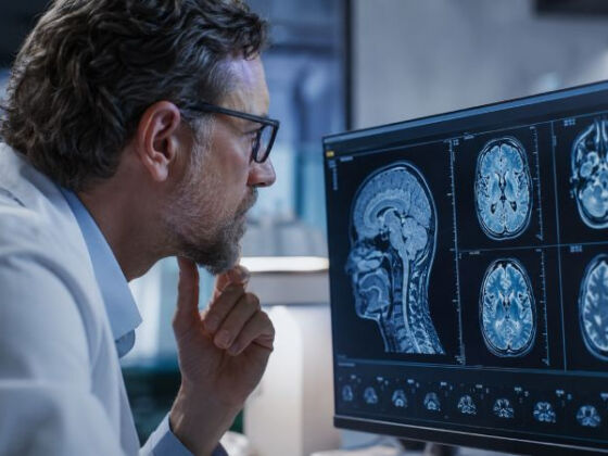 surpoids et cerveau une etude sur 3 600 personnes revele un lien alarmant
