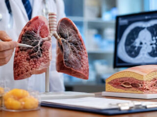 cancer poumon votre tour de taille revele risque